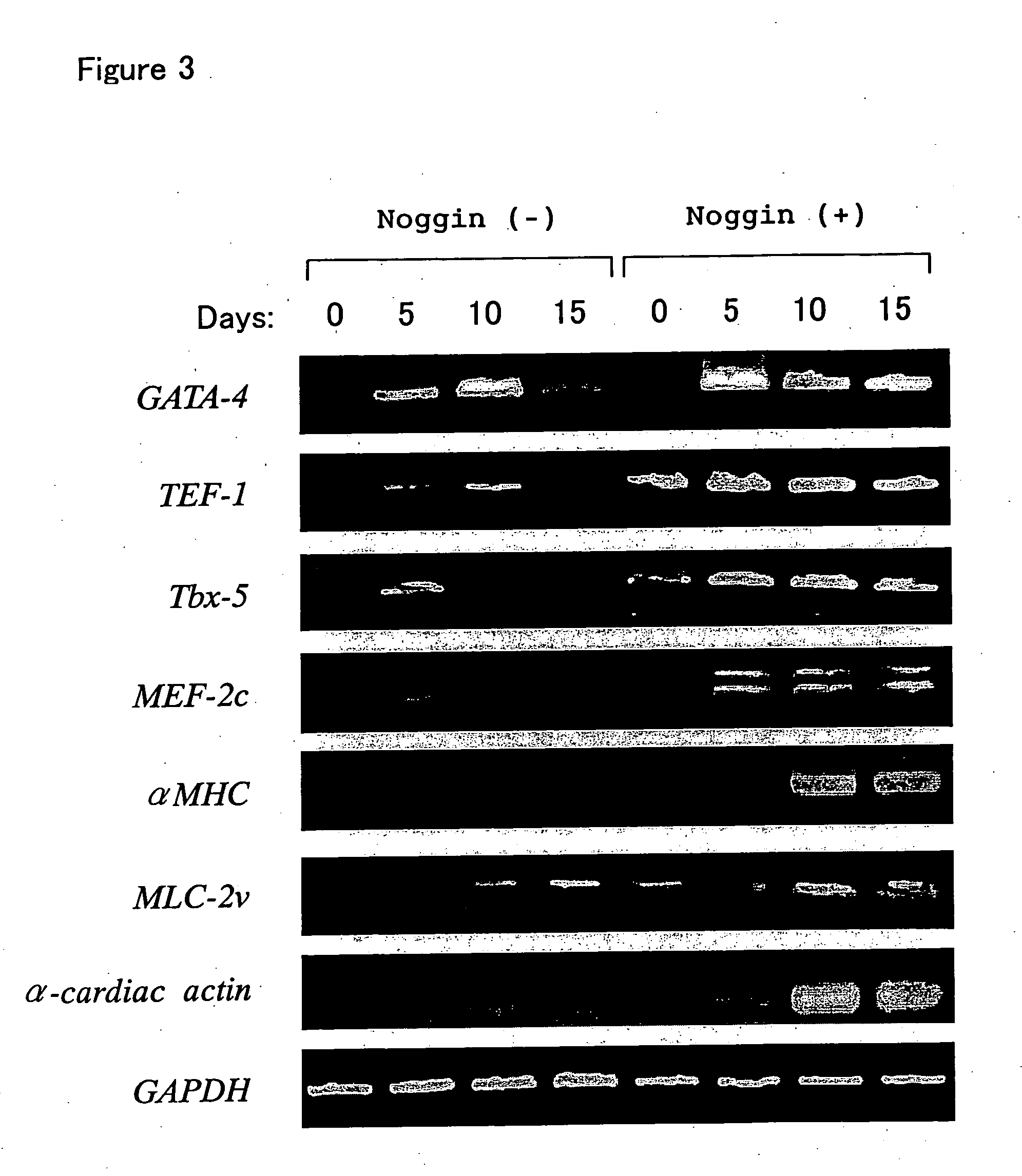 Method of inducing the differentiation of stem cells into myocardial cells