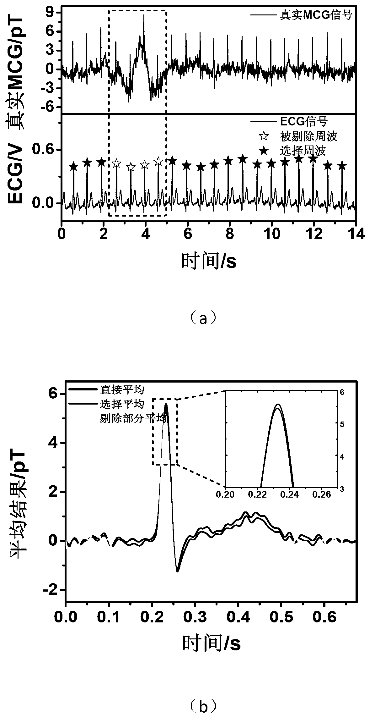 Selective cardiac-magnetic signal averaging method in signal noise suppression