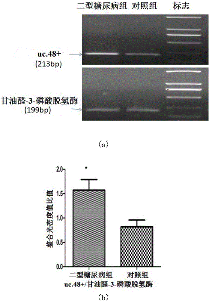Application of long non-coding RNA uc.48+ small interfering RNA to preparation of medicine for treating DM and complications