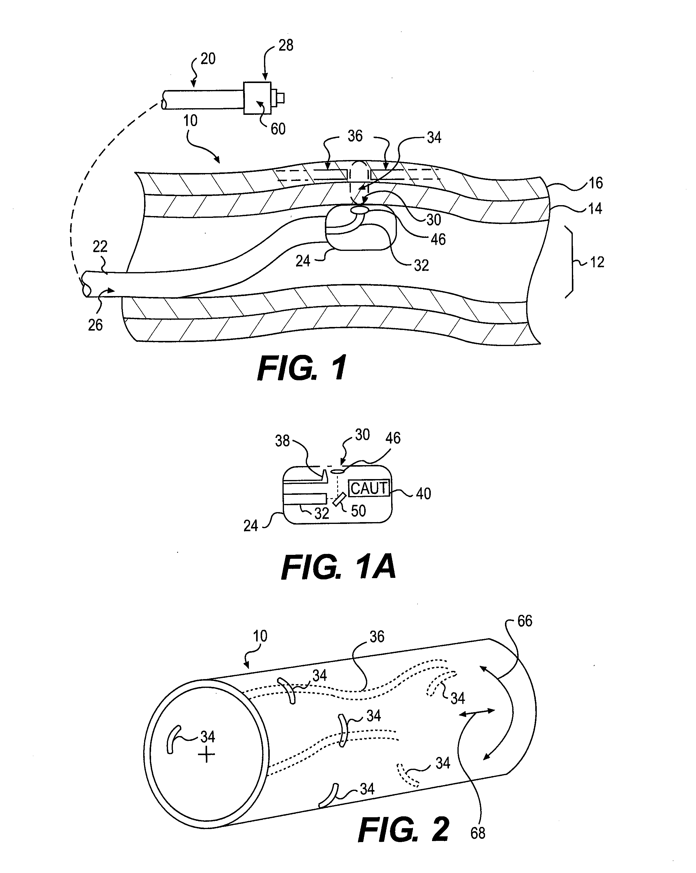 Catheter device and method for denervation