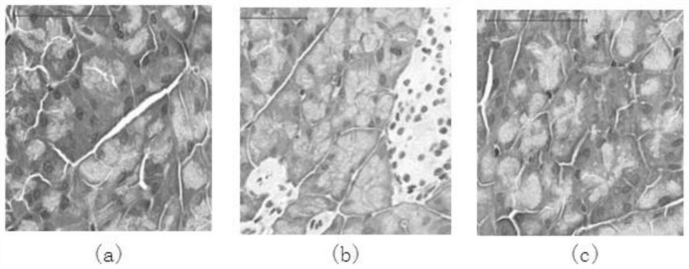 Complex microbial inoculant for relieving insulin resistance caused by long-term low-dose radiation exposure and application thereof