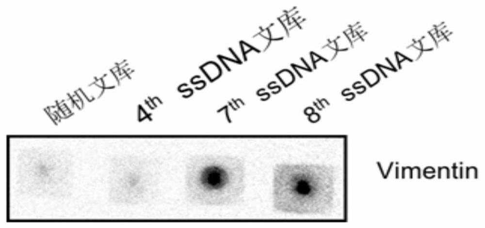 Nucleic acid aptamer specifically recognizing vimentin and its application