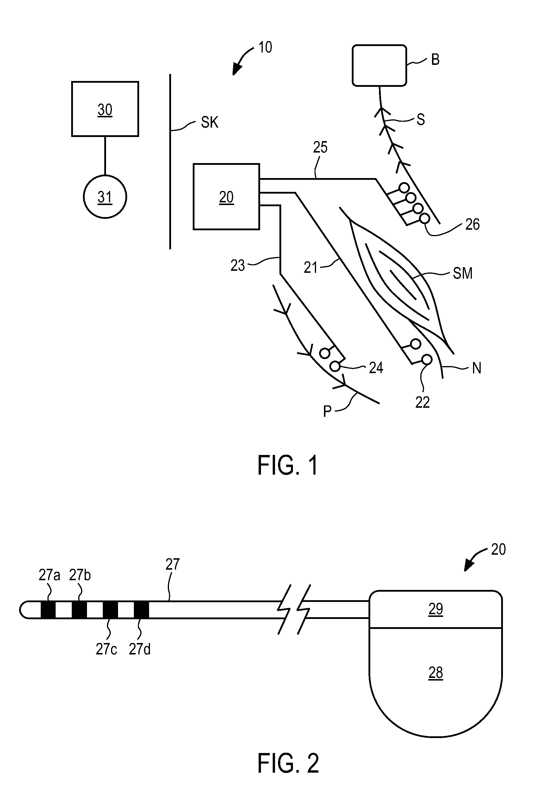 Modular stimulator for treatment of back pain, implantable RF ablation system and methods of use