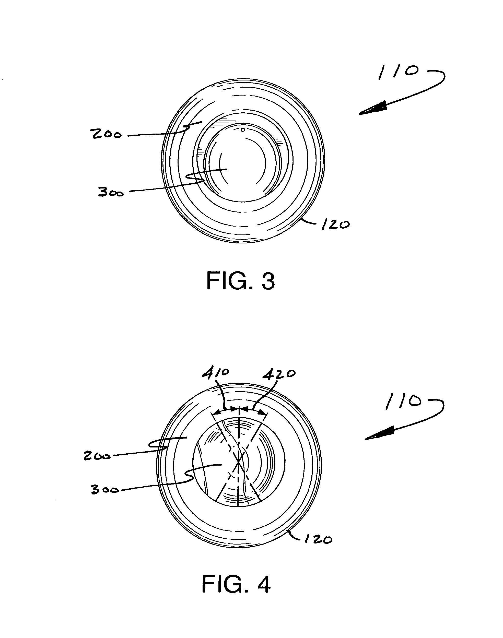 Artificial eye socket system and method