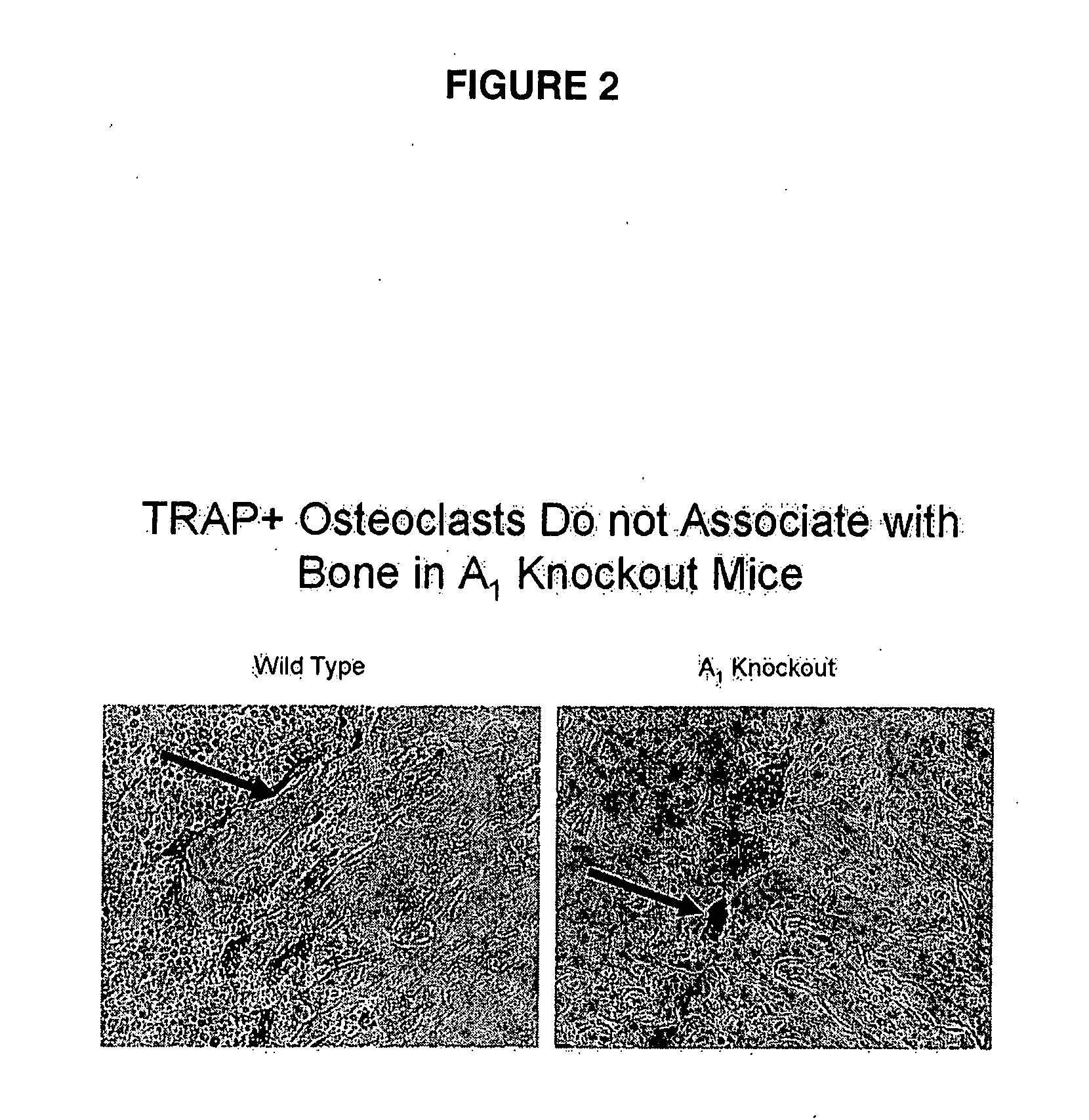 Methods and compositions for treating disorders associated with increased bone turnover and osteopenia