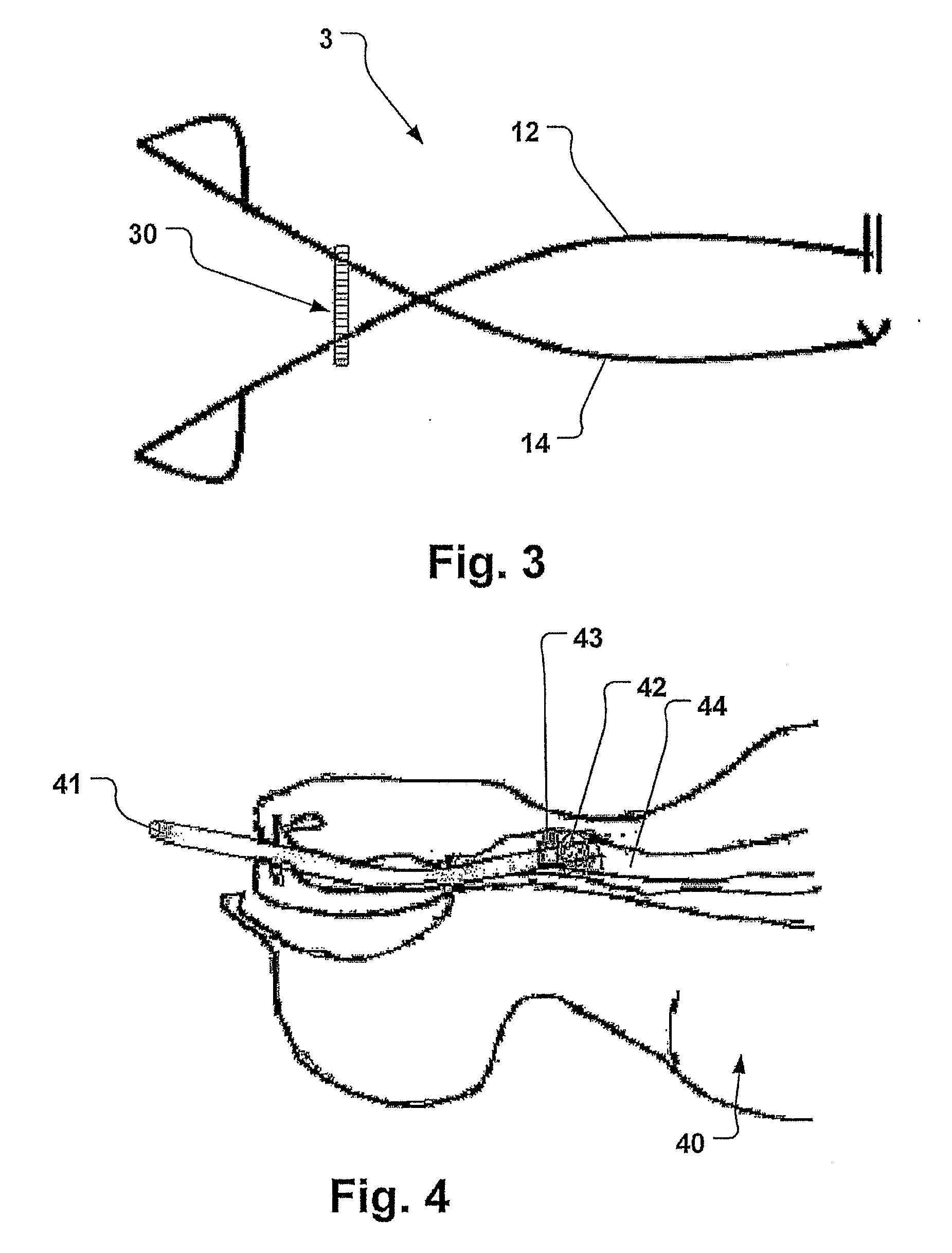 Device and Method for Tracheotomy