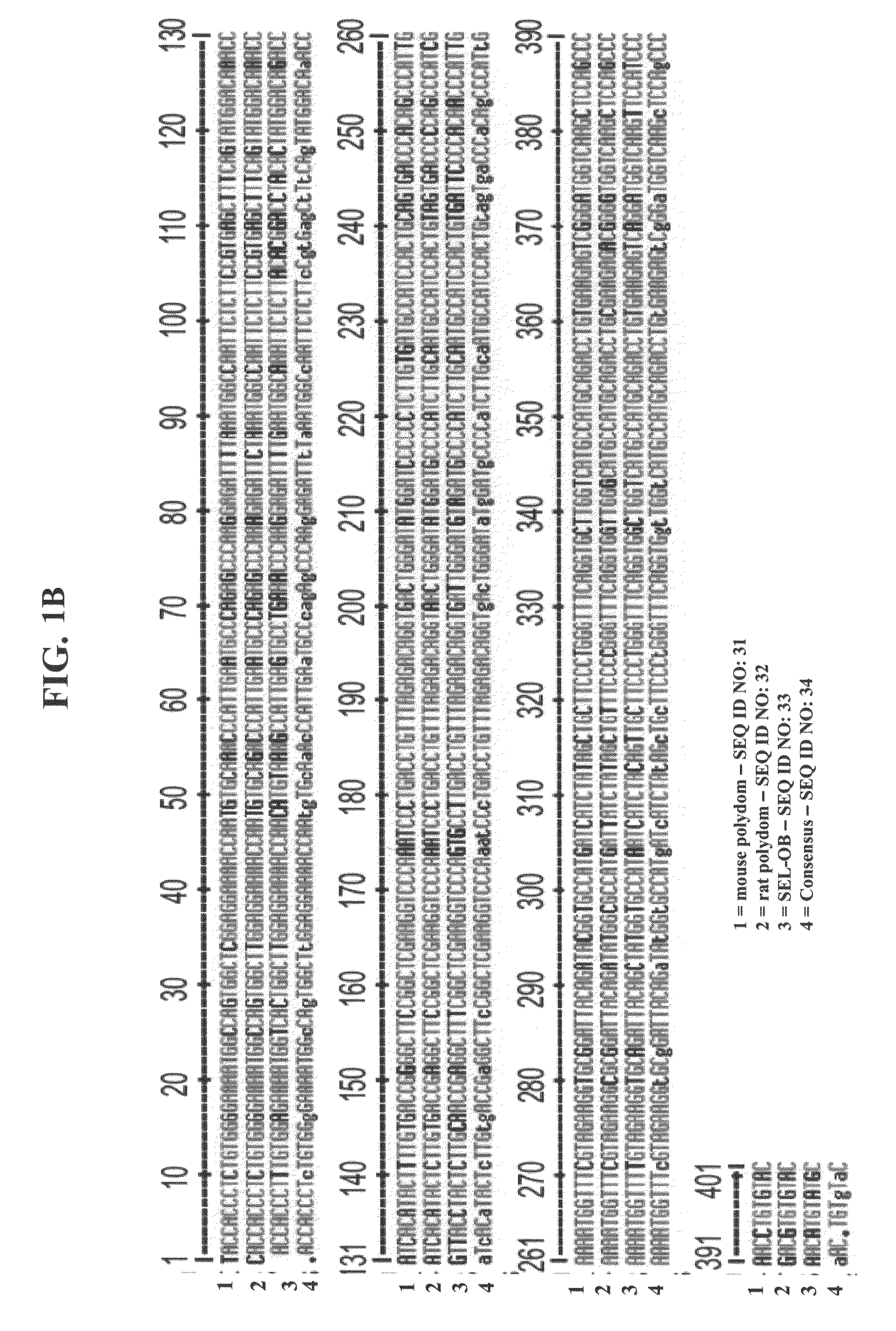 Polypeptides, polynucleotides encoding same, antibodies thereagainst and methods of using same for diagnosing and treating cancer and skeletal disorders