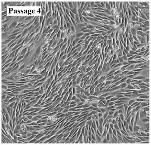 Umbilical cord mesenchymal stem cell exosome, preparation method and application of exosome to cosmetic