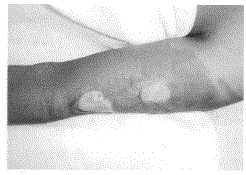 Preparation method and application of clean fine-core sterile heterogeneous sigmoid membrane