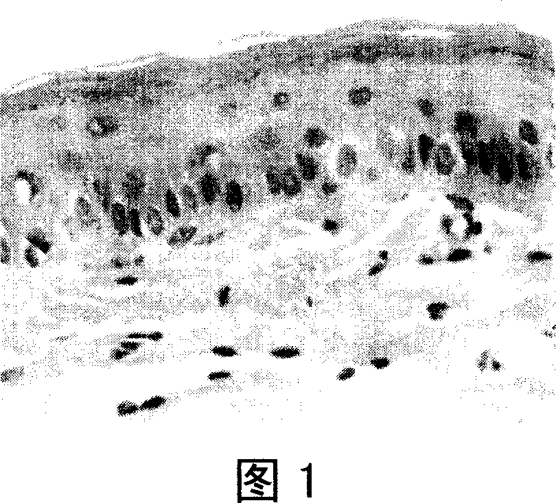 Method of thalidomide for effective intervening oral cancer in animal model