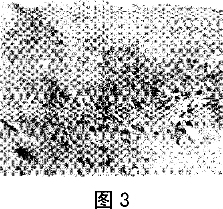 Method of thalidomide for effective intervening oral cancer in animal model