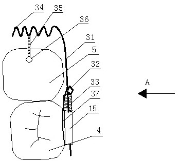 Anterior tilting molar erector with two-way force system