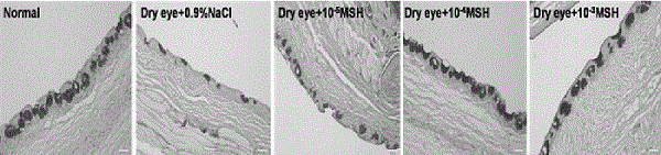 Application of novel eye drops in treatment of dry eyes