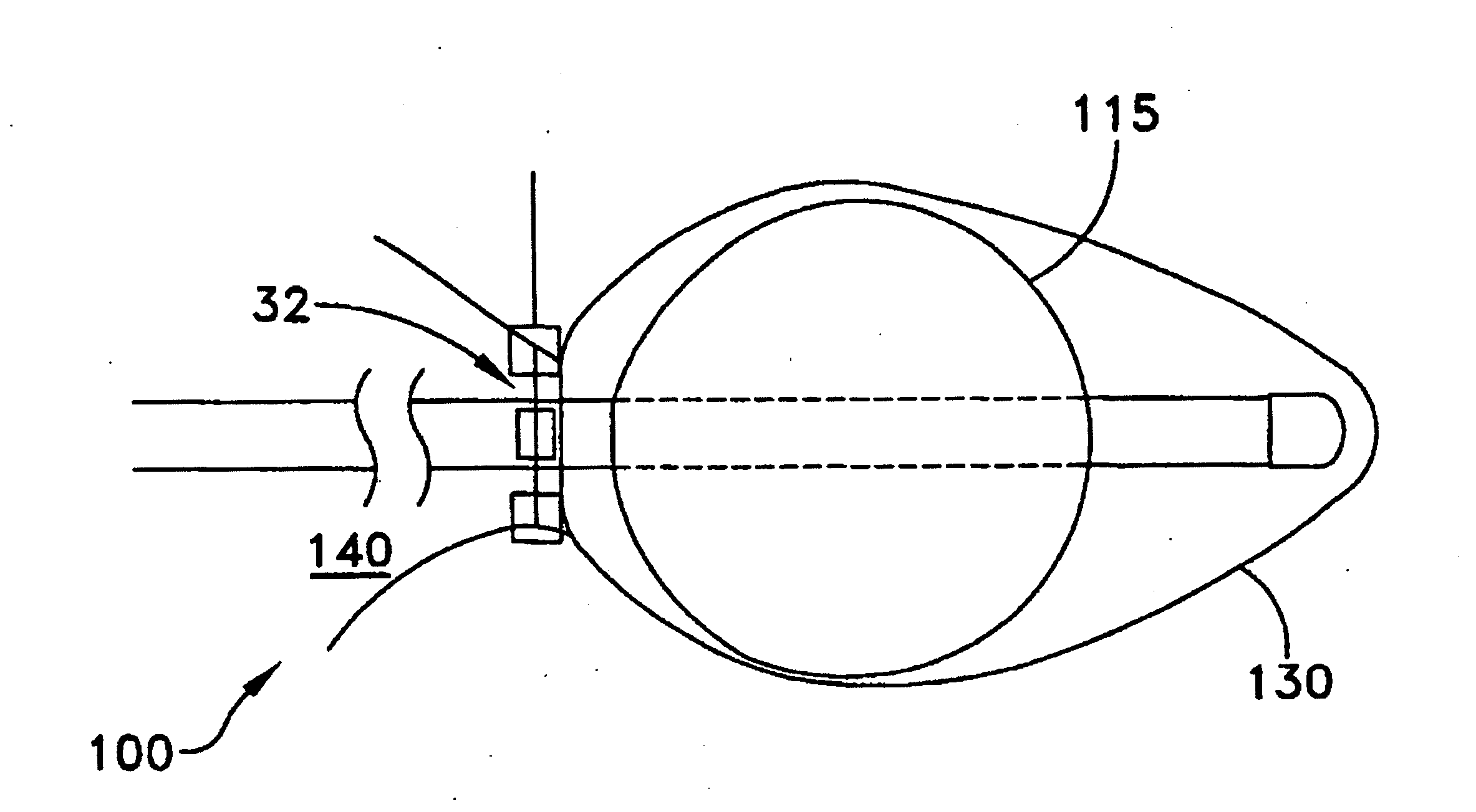 Apparatus and method for the ligation of tissue