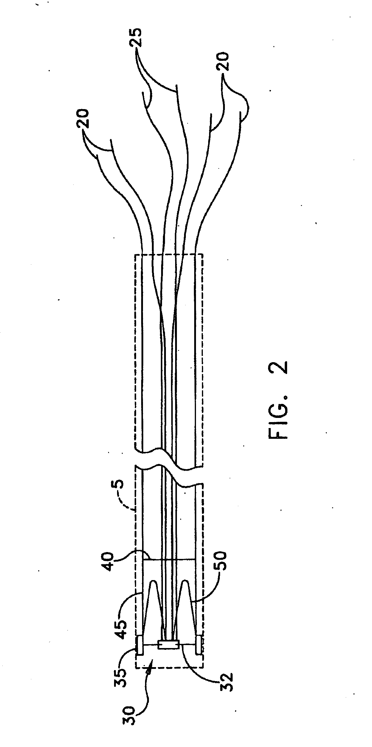 Apparatus and method for the ligation of tissue