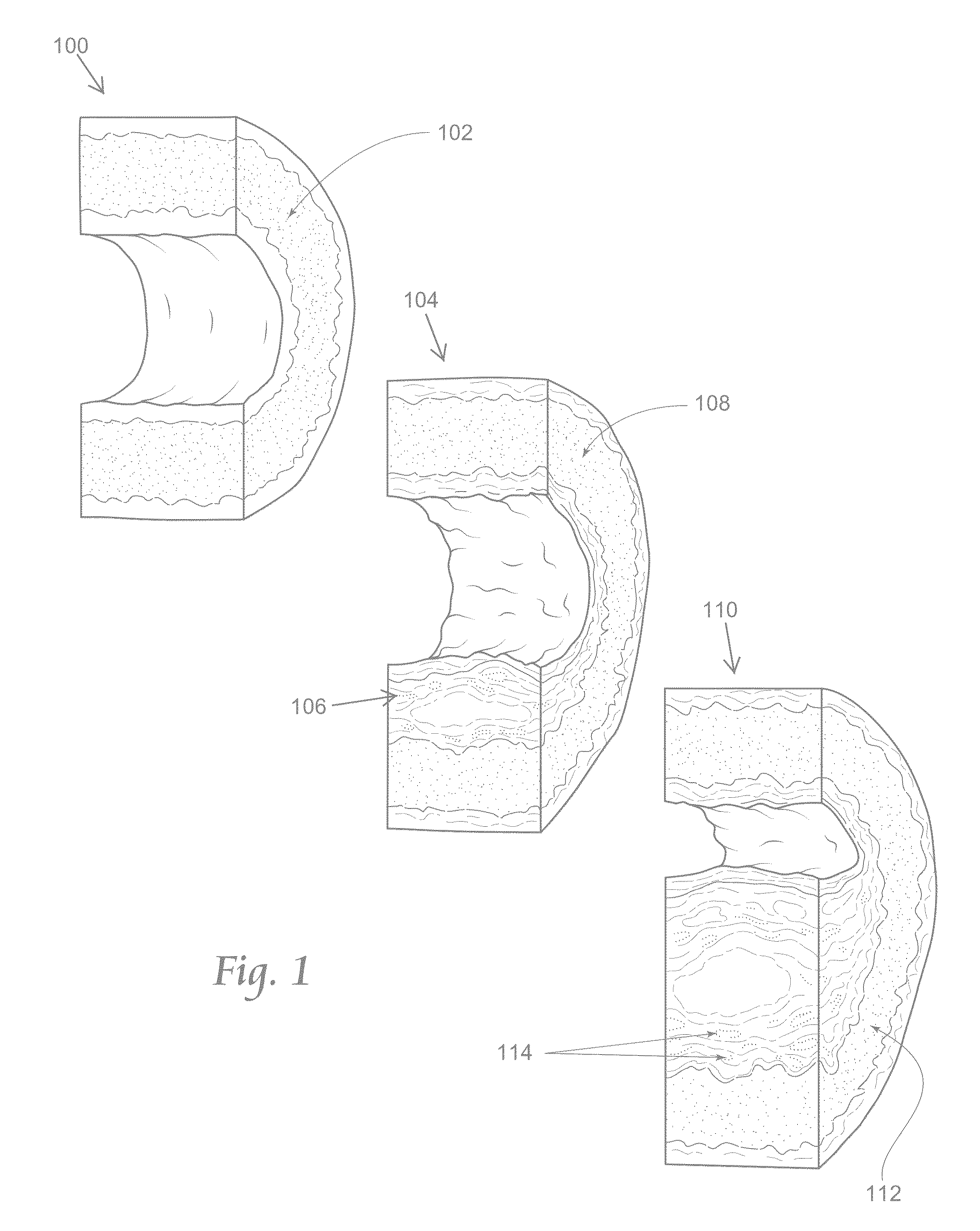 Atherectomy apparatus, systems and methods