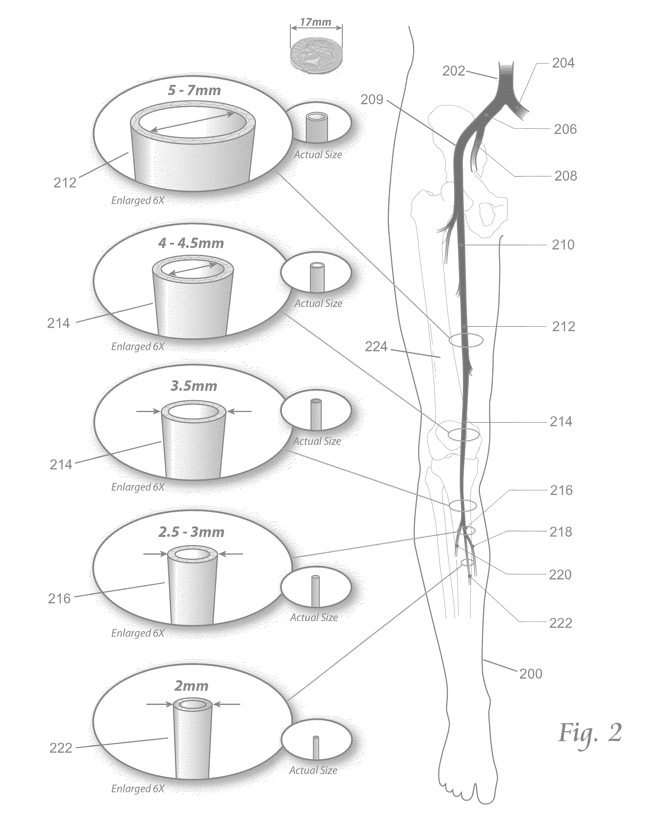 Atherectomy apparatus, systems and methods