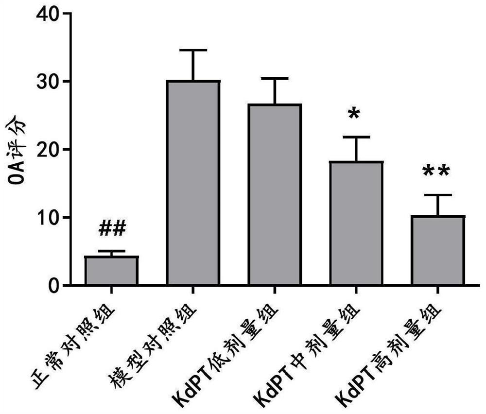 KdPT polypeptide for treating osteoarthritis and application thereof