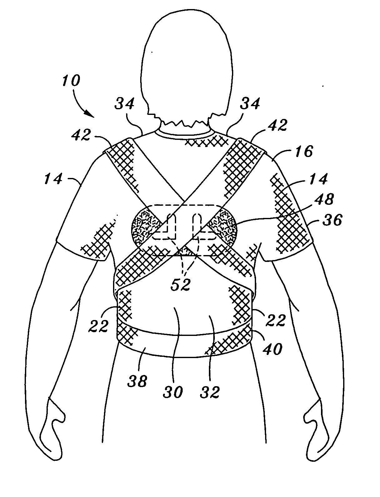 Posture improvement device and method of use