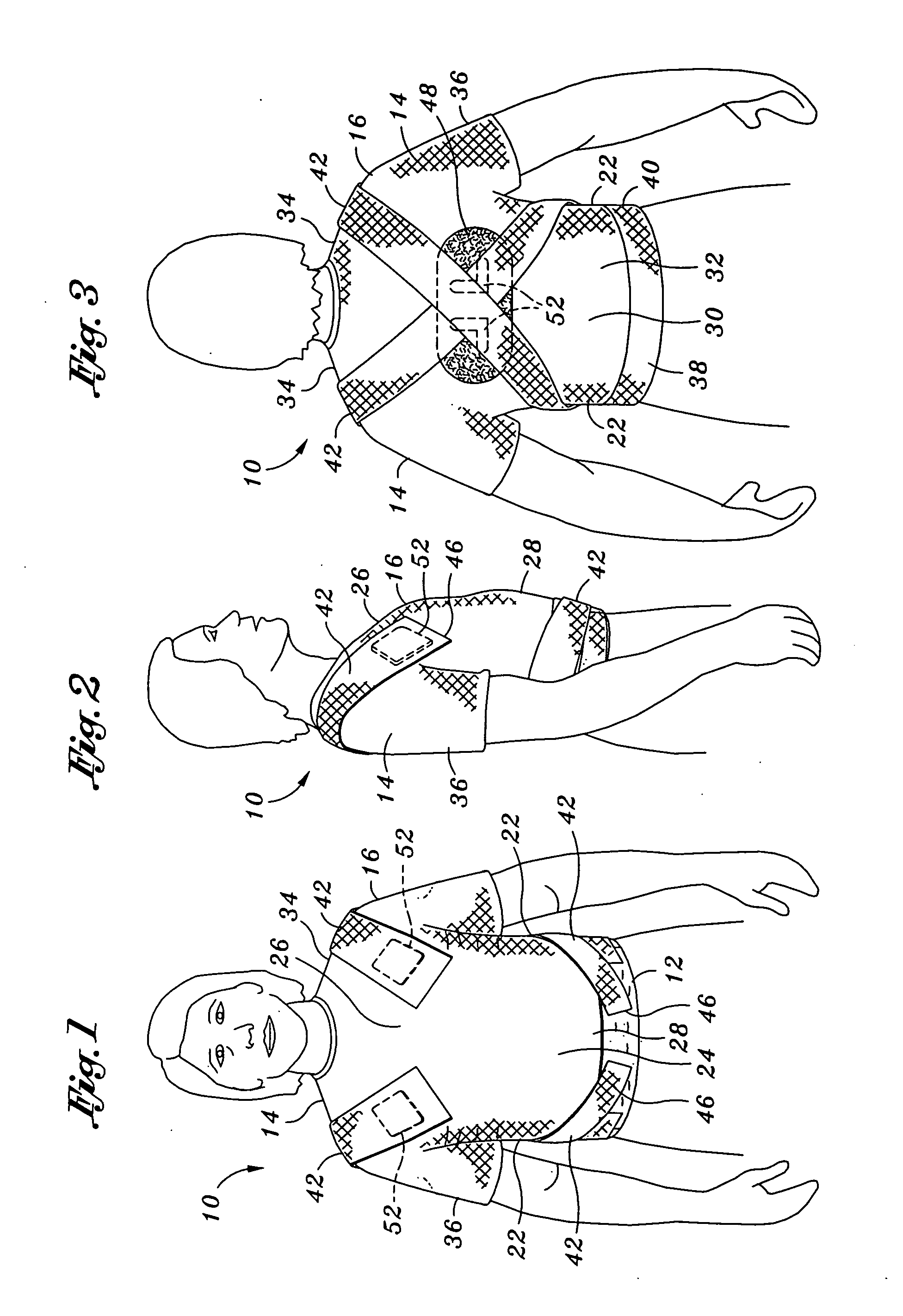 Posture improvement device and method of use