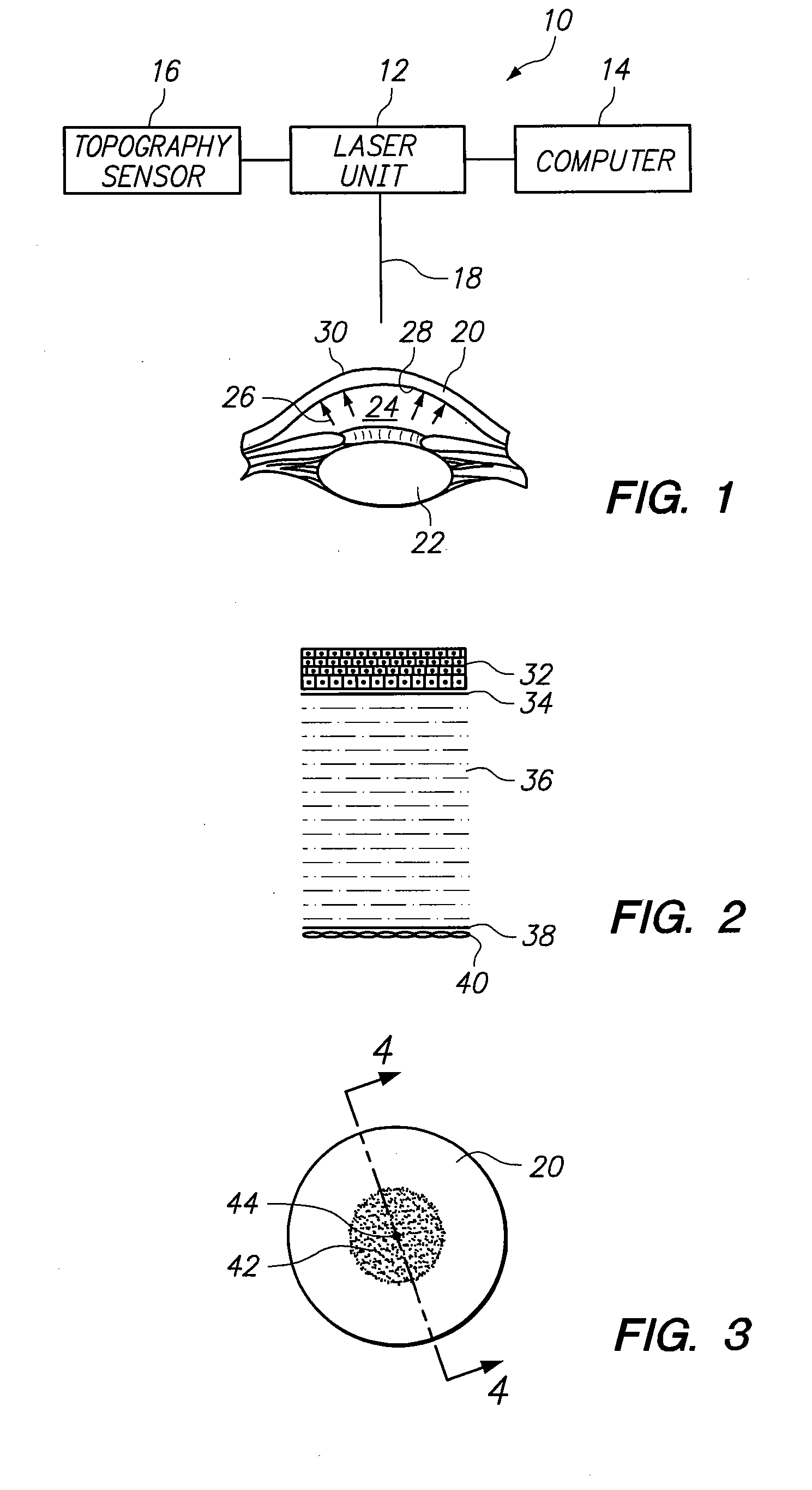 System and method for altering internal stress distributions to reshape a material