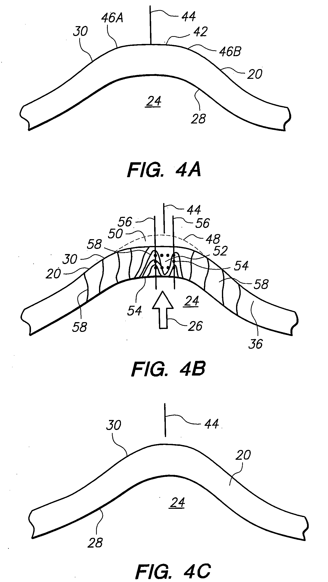 System and method for altering internal stress distributions to reshape a material