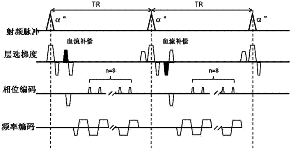 Measurement method and device for cardiac blood flow speed of magnetic resonance