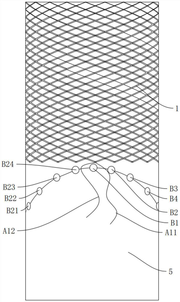 Filter screen weaving method, filter screen and embolism protector