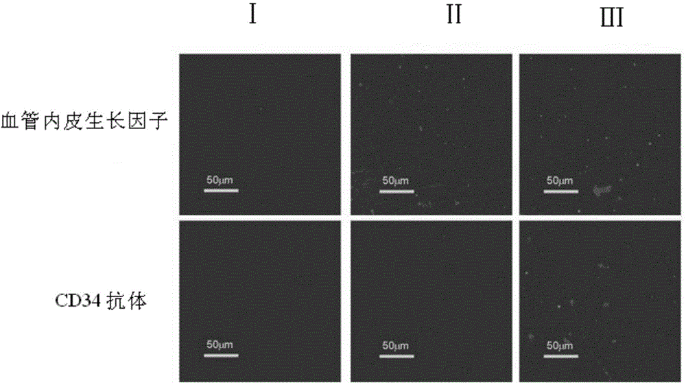 Method for preparing degradable drug-loaded coating stent