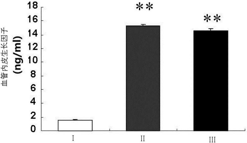 Method for preparing degradable drug-loaded coating stent