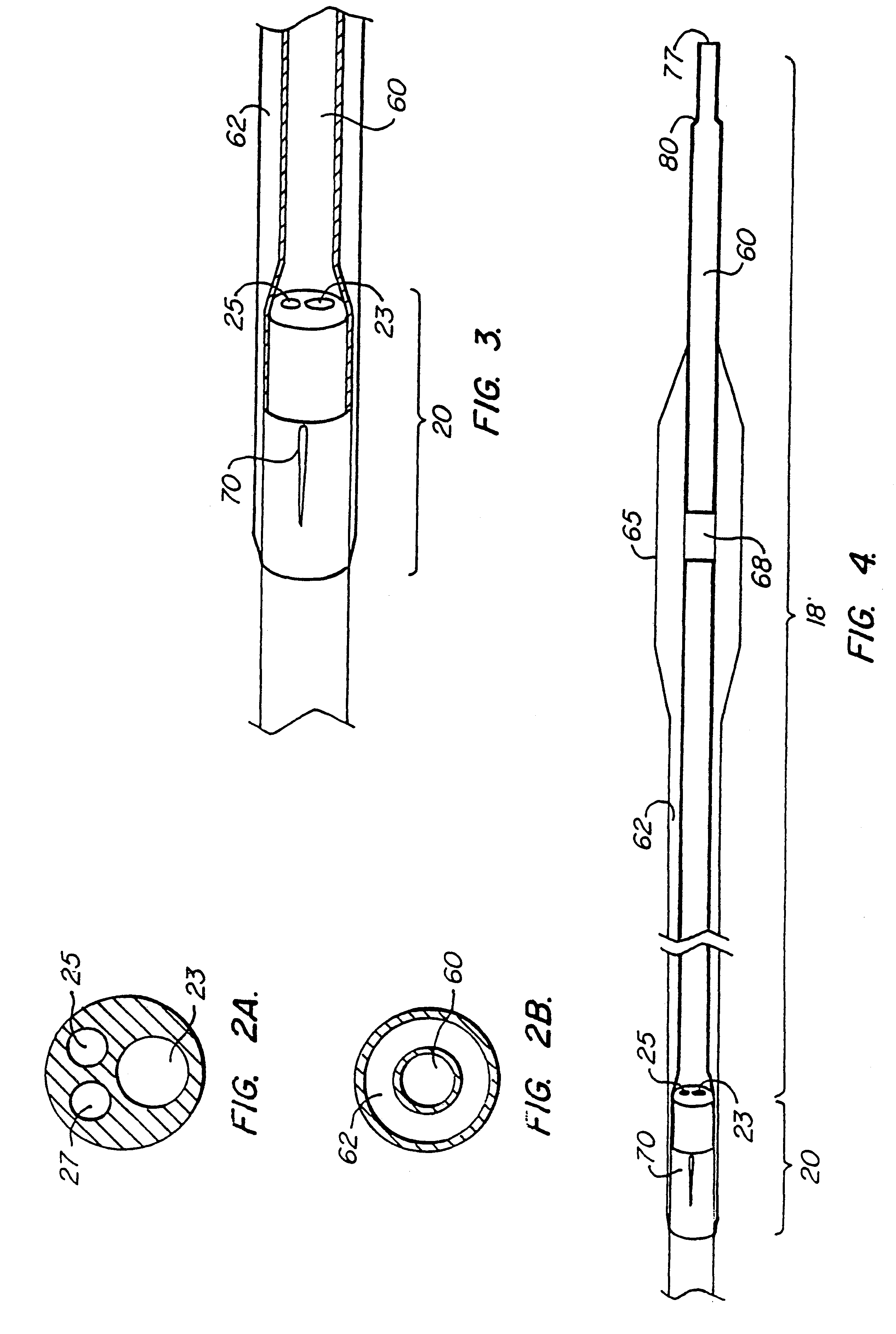 Catheter system having a balloon angioplasty device disposed over a work element lumen