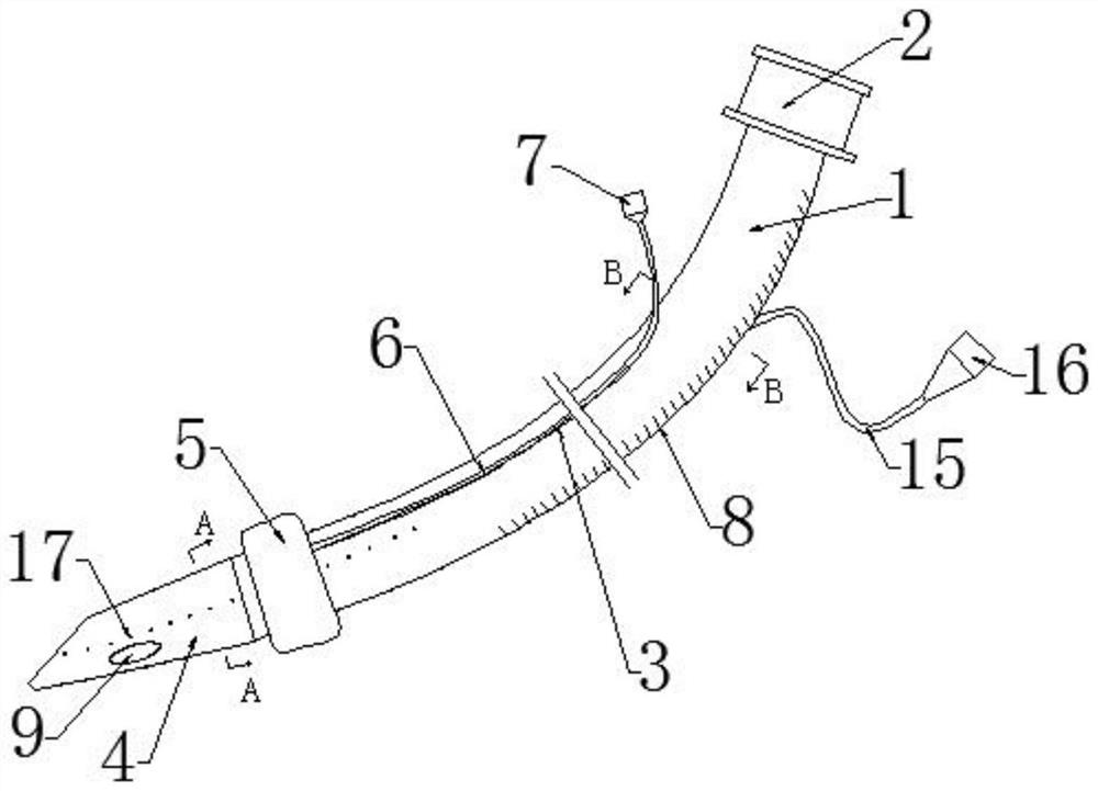 Tracheal tube capable of realizing airway surface anesthesia