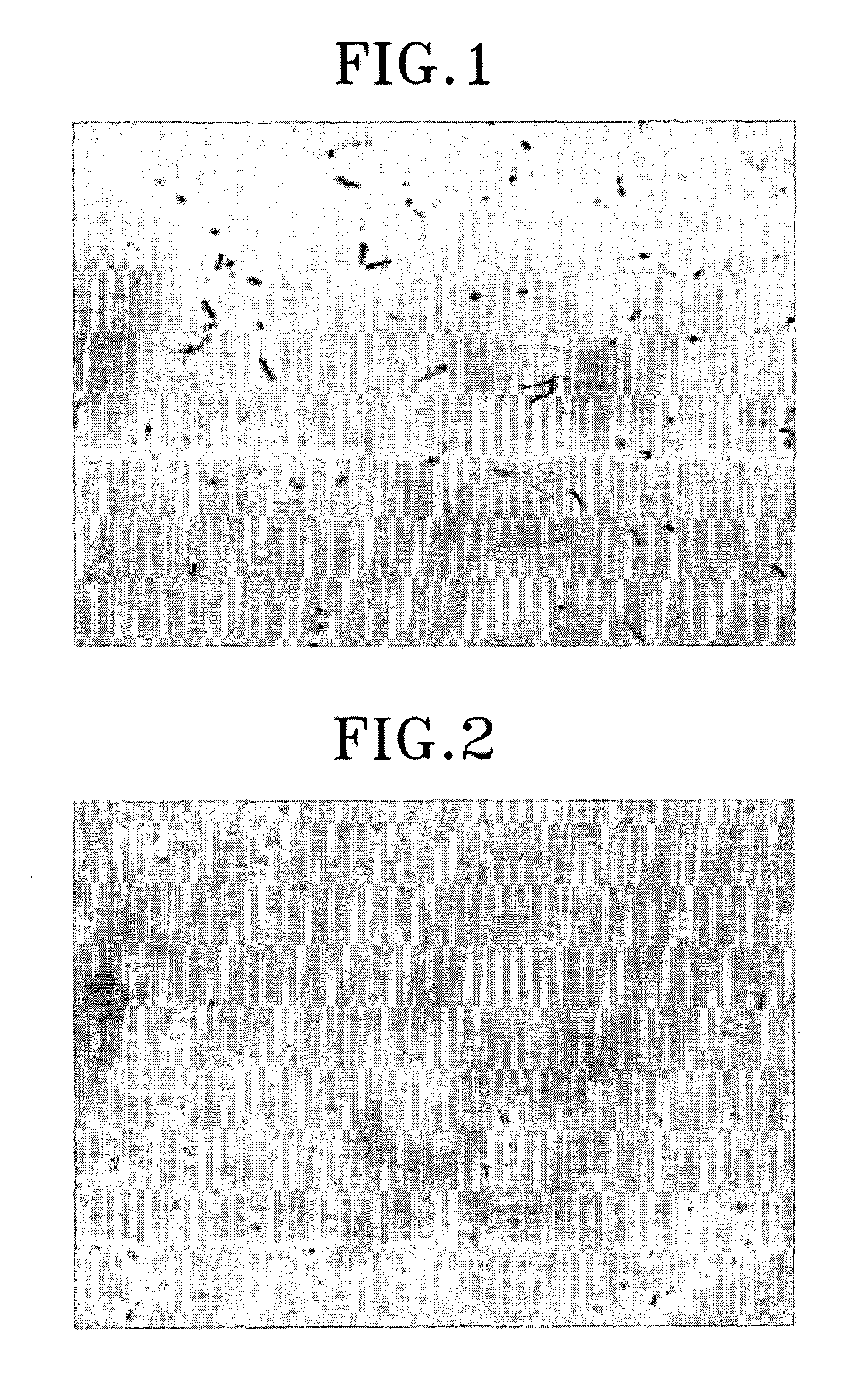 Method for expression of proteins on spore surface