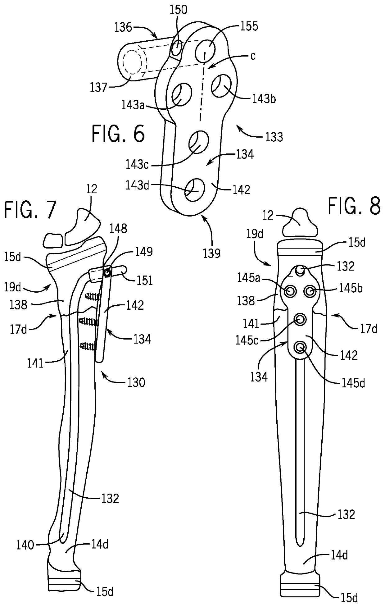 Fracture fixation device having clip for stabilizing intramedullary nail