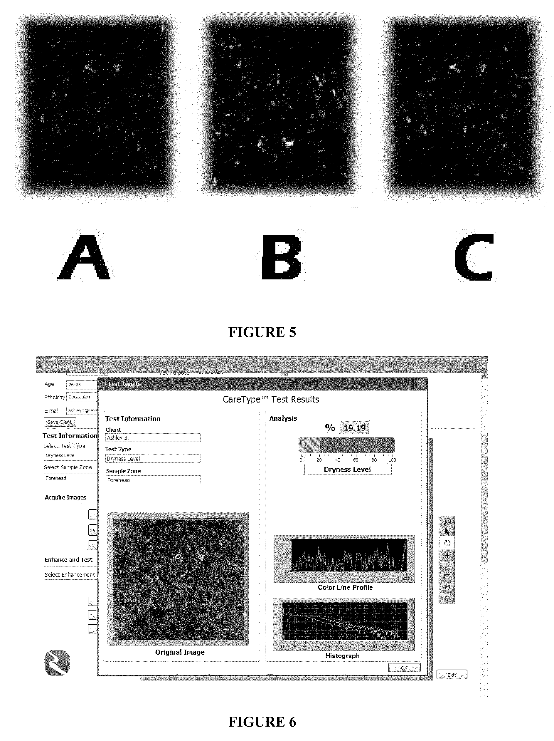 Method and apparatus for analyzing skin and hair