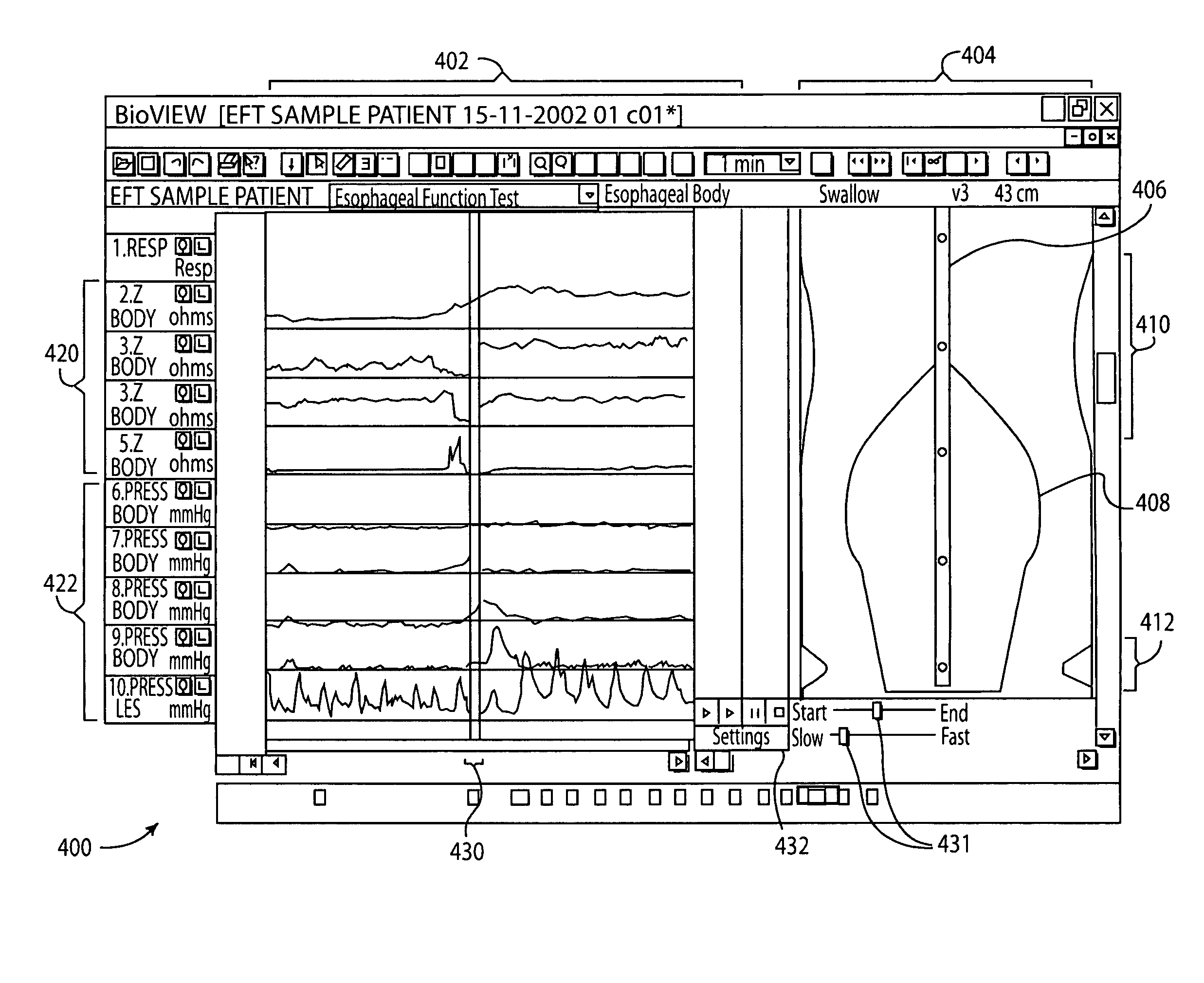 Esophageal function display and playback system and method for displaying esophageal function