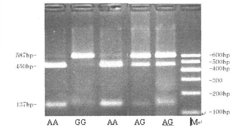 Detection method of single nucleotide polymorphism and molecular markers of cattle FBXO32 genes