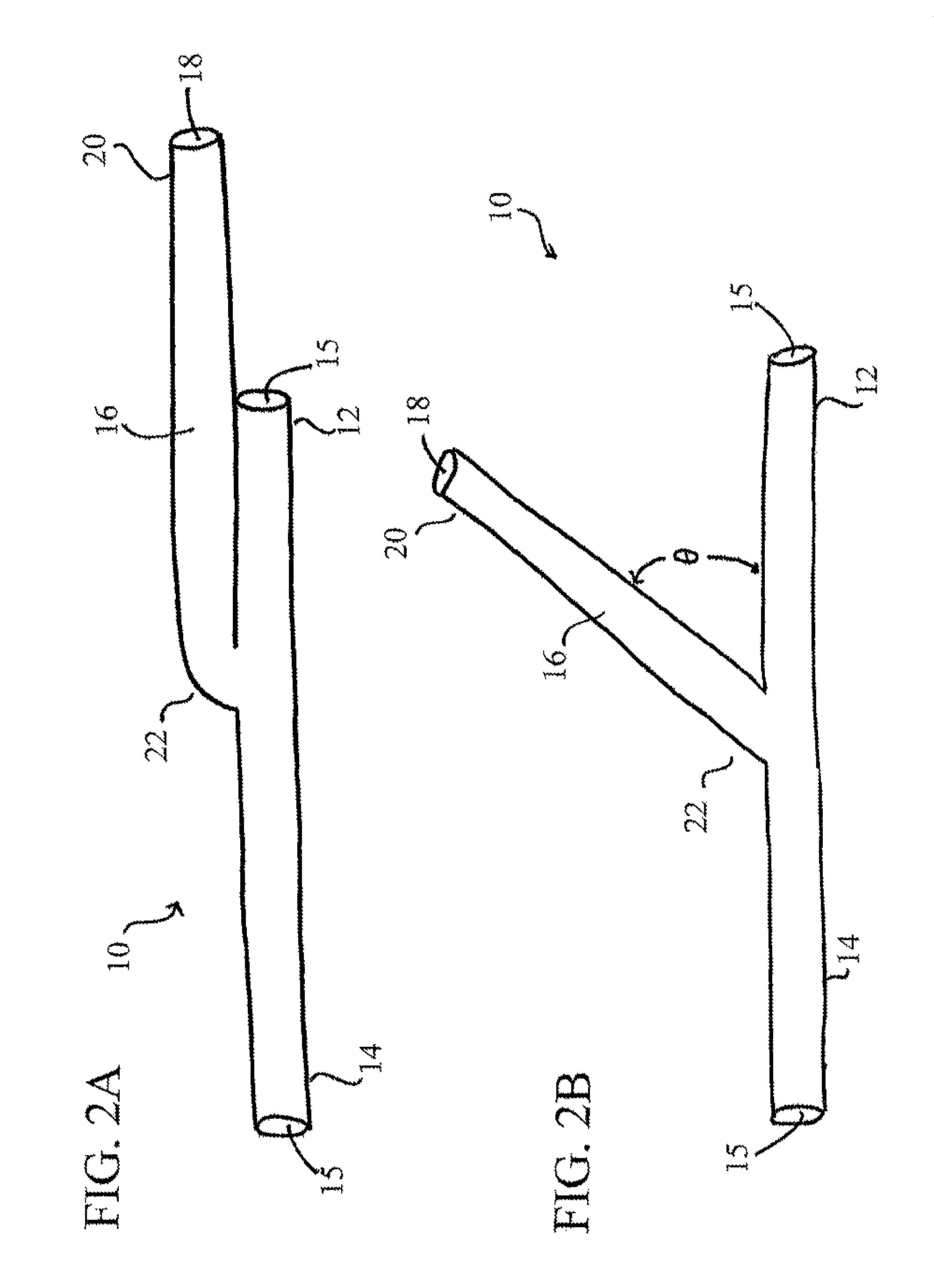 Devices, systems, and methods for organ retroperfusion