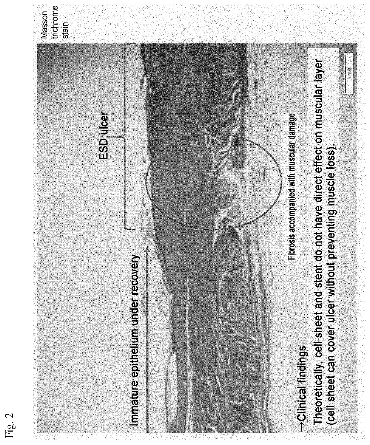 Esophageal stricture suppressing agent