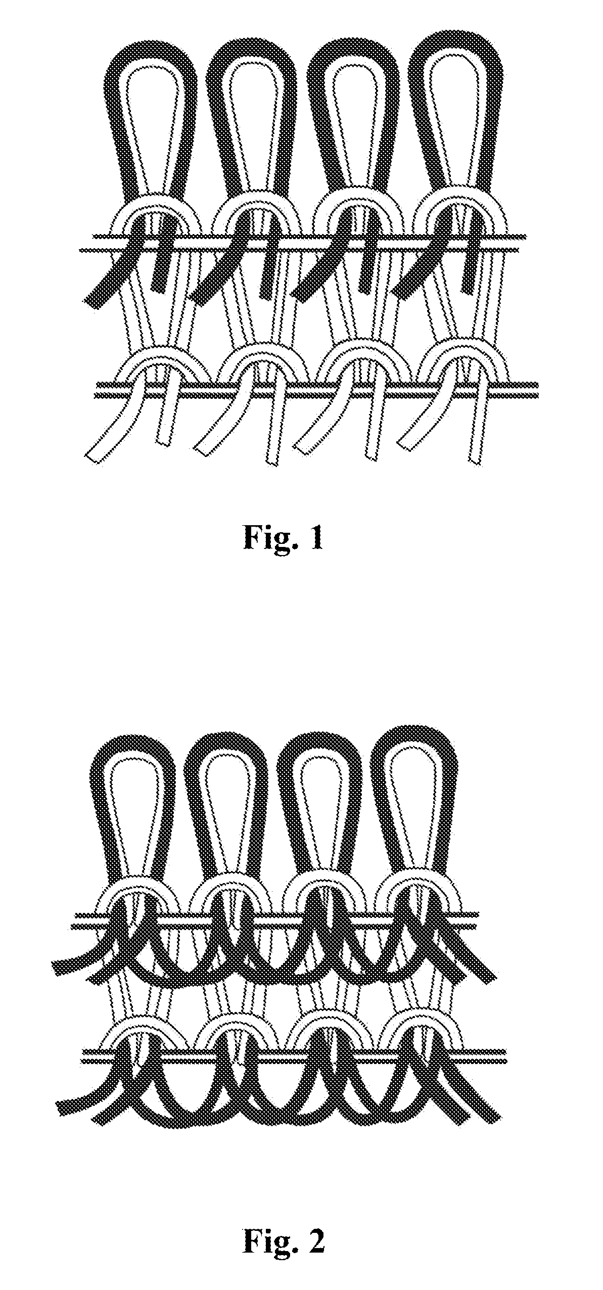 High hygroscopic wound dressing and preparation method and use thereof