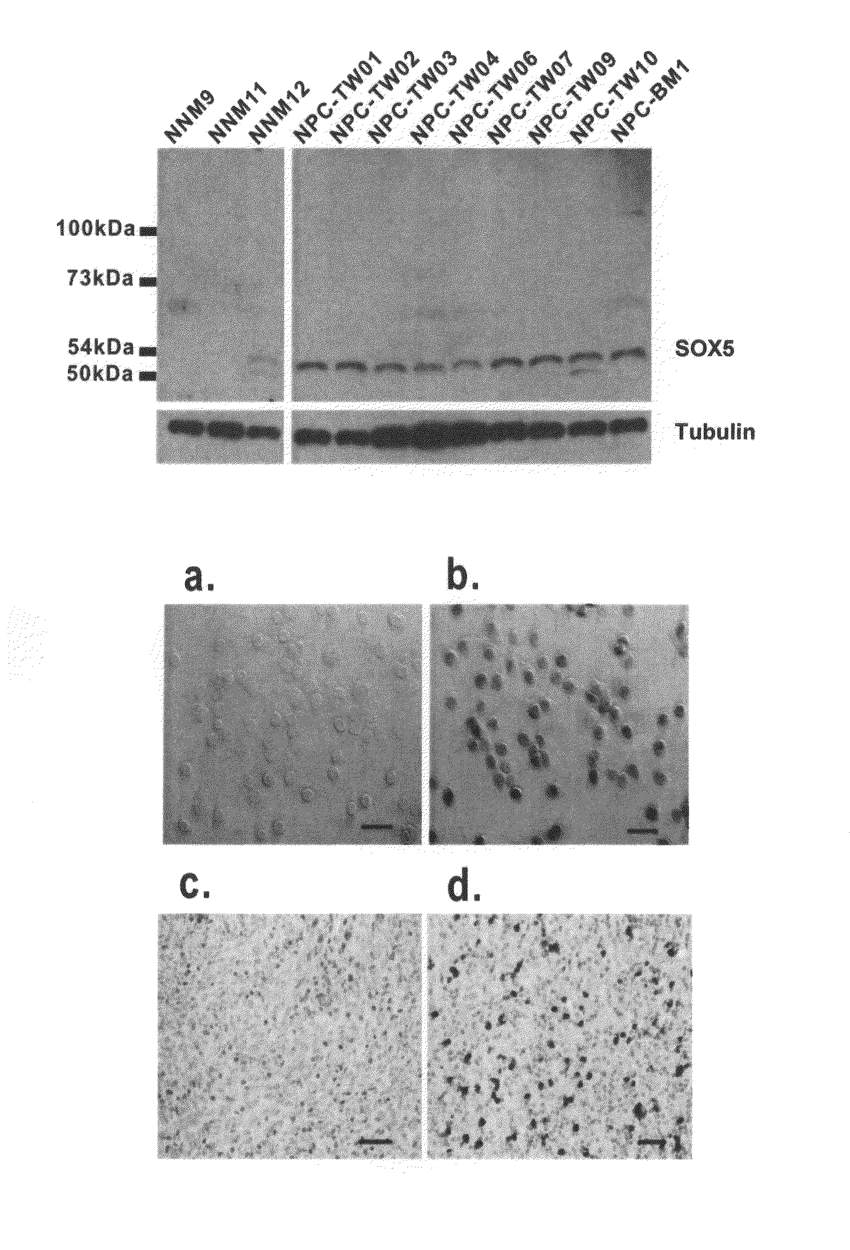 Genetic markers and methods for detecting and treating cancers