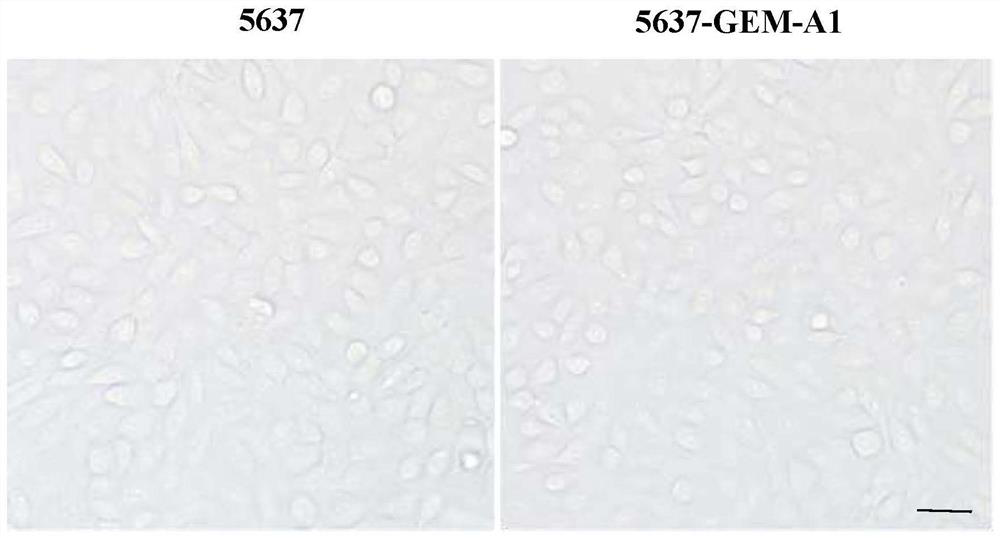 Human bladder cancer gemcitabine drug-resistant cell strain and application thereof