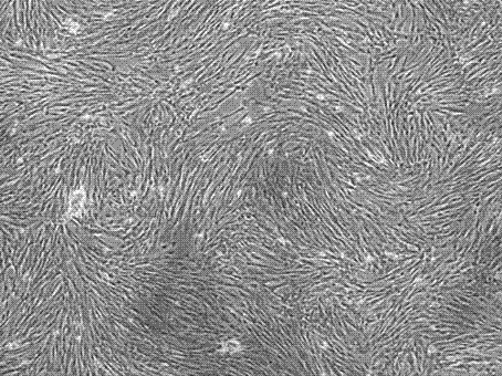 Human placenta chorion mesenchymal stem cell culture system