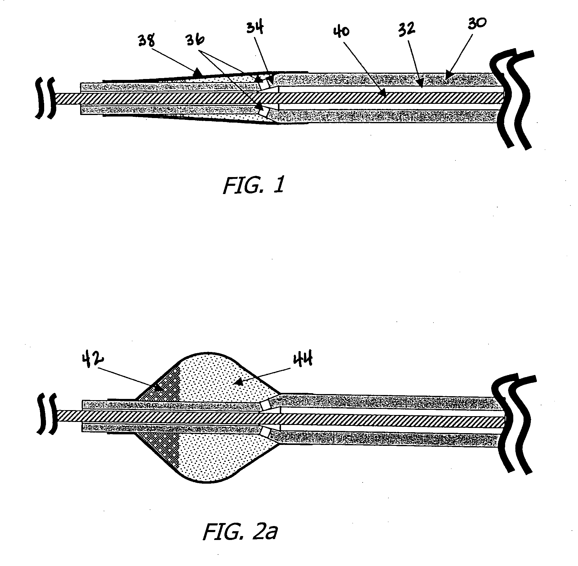 Catheter mounted automatic vessel occlusion and fluid dispersion devices