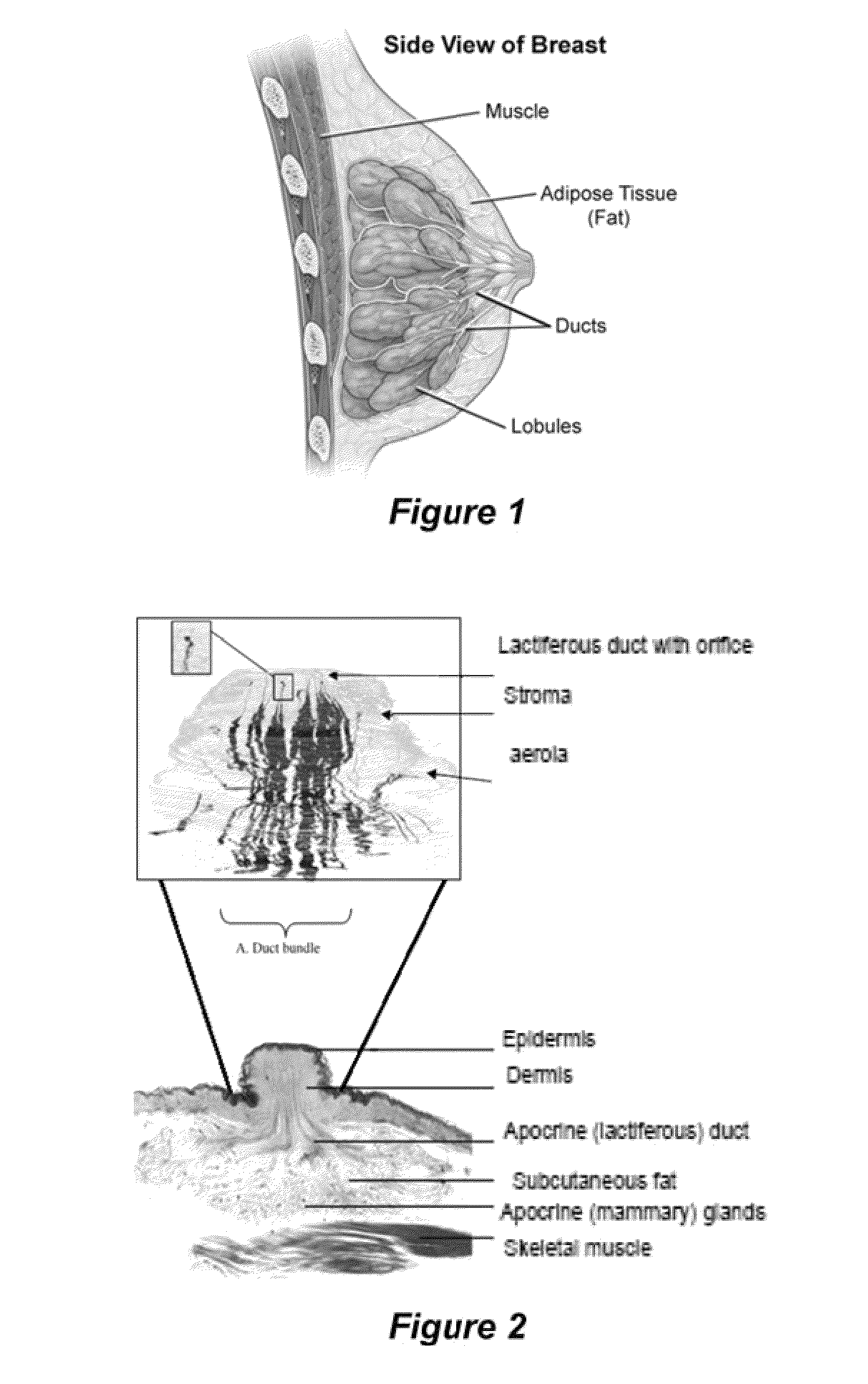 Compositions and methods for localized drug delivery through mammary papillae