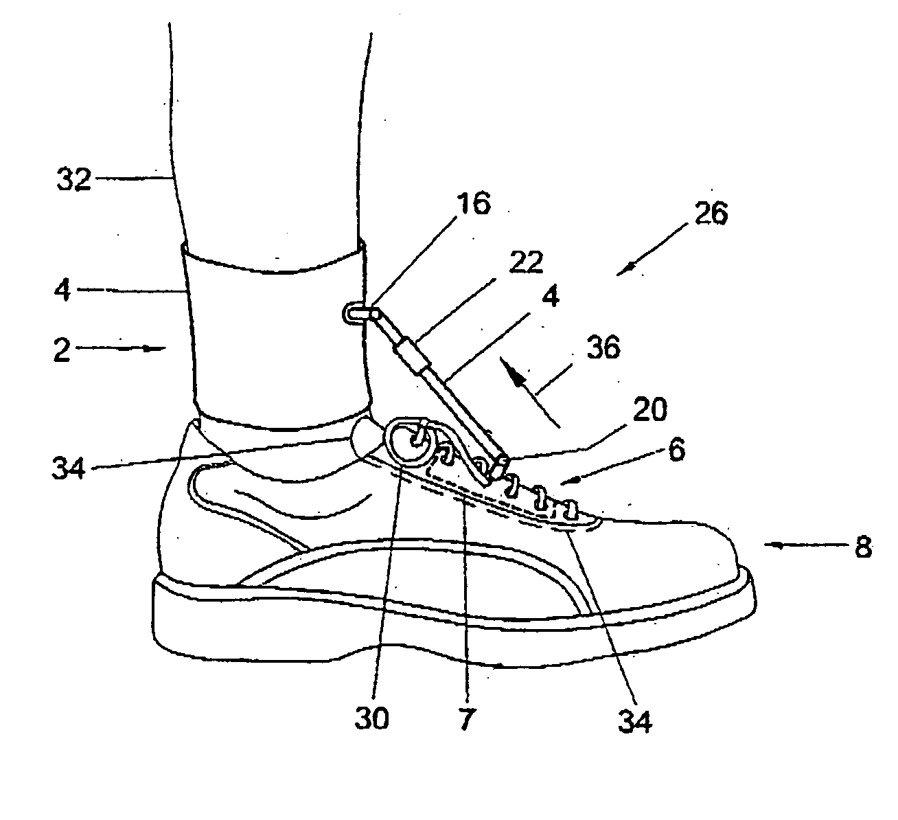 Drop foot device