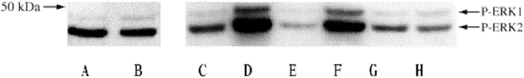 Method for determining retinal cell death process