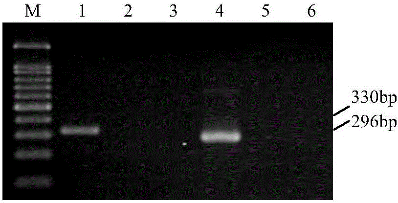 Nested RT-PCR detection kit of bean pod mottle virus ELISA and detection method of nested RT-PCR detection kit