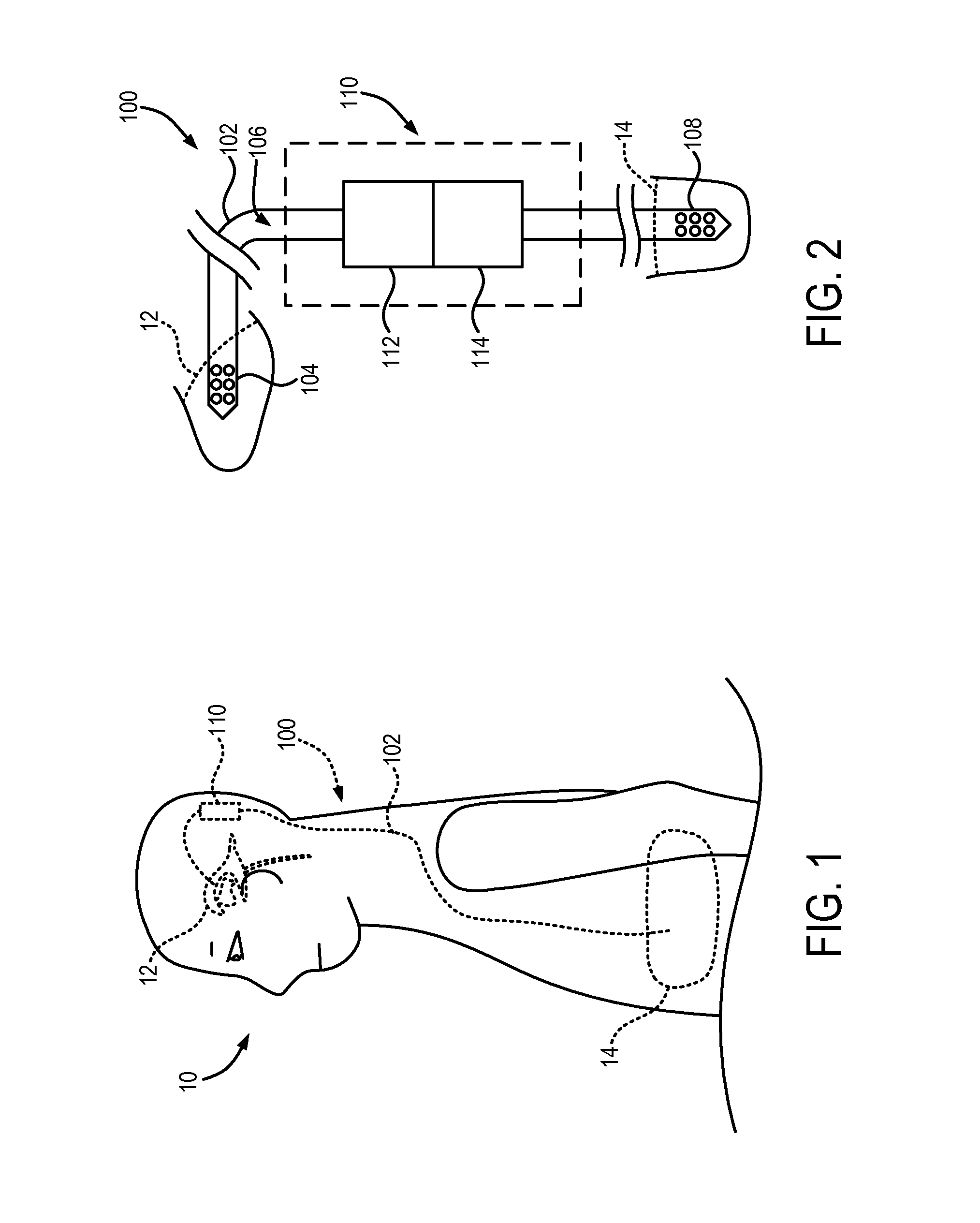 Systems and methods for controlling cerebrospinal fluid in a subject's ventricular system
