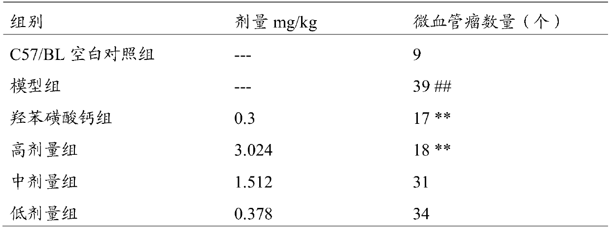 Application of traditional Chinese medicine composition in preparation of medicine for preventing and treating diabetic retinopathy